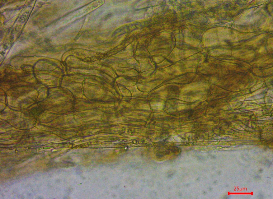 Monilinia baccarum 28 Excipulum ectale Medulla entale duenne Hyphen angeschwollen breit textura Mikroskopie Becherlinge discomycetes Krieglsteiner in vivo veritas Custom