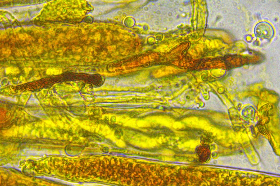 Pezicula acericola 10 Paraphysen braun gefaerbt Lugol Baral Jod Krieglsteiner Mikroskopierkurs Seminarprogramm Pilzkurs Schlauchpilz Becherling Ahorn Rindenbecherchen asco sonneberg