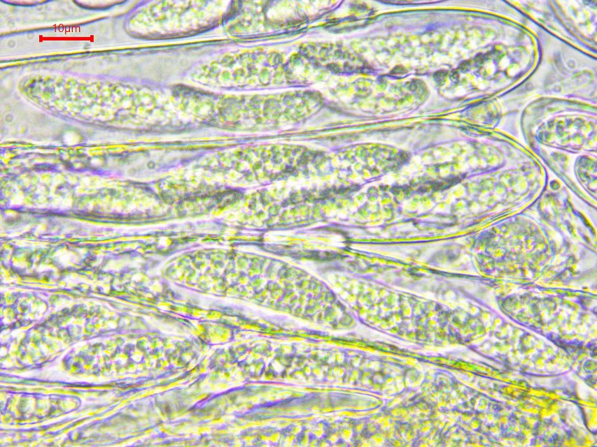 Pezicula acericola 4 ASci Sporen oelreich multiguttulat achtsporig Wasser lebend Vitaltaxonomie Baral Krieglsteiner Pilzschule Schwaebischer Wald Mikroskopierkurs Helotiales Bergahorn