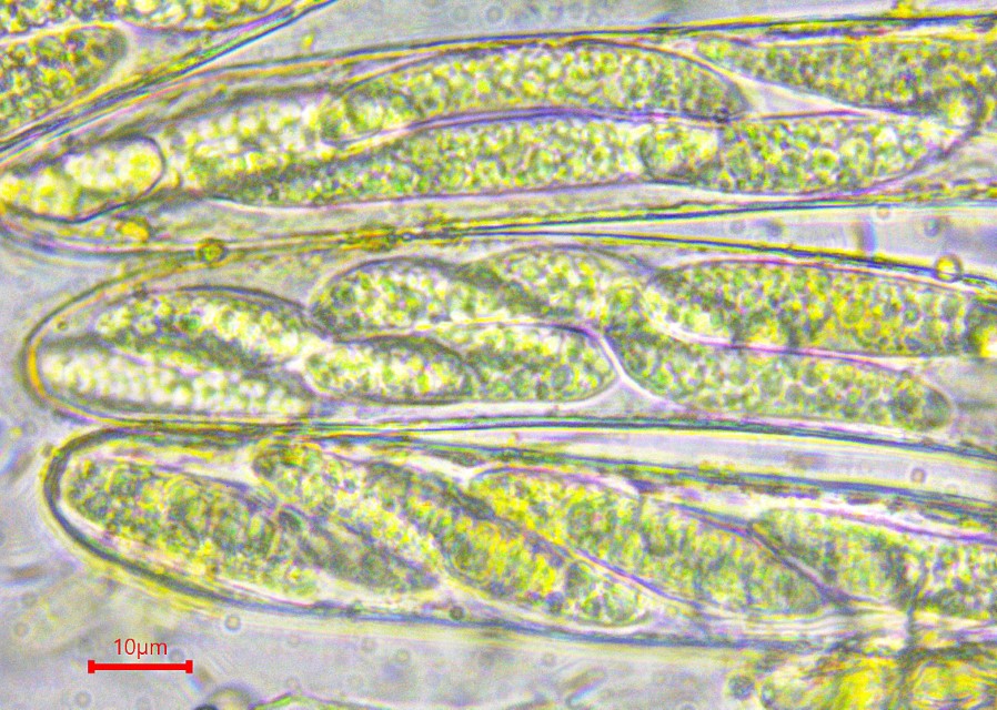 Pezicula acericola 6 ASci achtsporig zweireihig multiguttulat Lugol Baral Paraphysen Acer pseudoplatanus Bergahorn Ast carpinea Hainbuche Schwaebische Alb Kartierung Feldmykologe Pilz