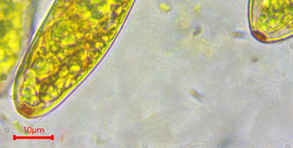 Pezicula acericola 9a Ascus Apikalapparat Porus rot hemiamyloid dextrinoid Polysaccharide dehnbar Mikroskopierkurs Krieglsteiner Feldmykologe Ausvbildung DGfM Weissenstein Bergahorn