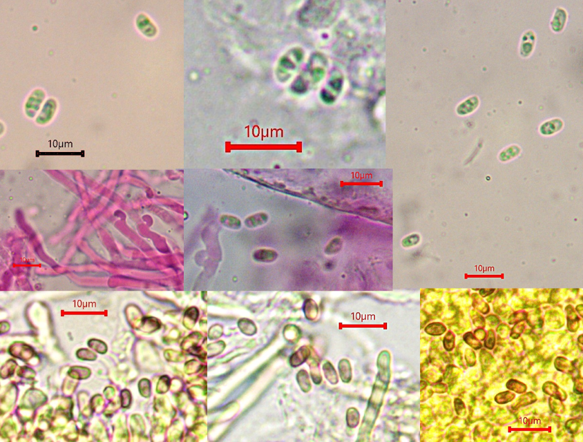 Sarcoporia polyspora Parmastomyces mollissimus Zartrandiger Weichporling Weicher Gelwachsporling Bayern Mittelfranken Mittelfrankisches Becken Sporen Tropfen