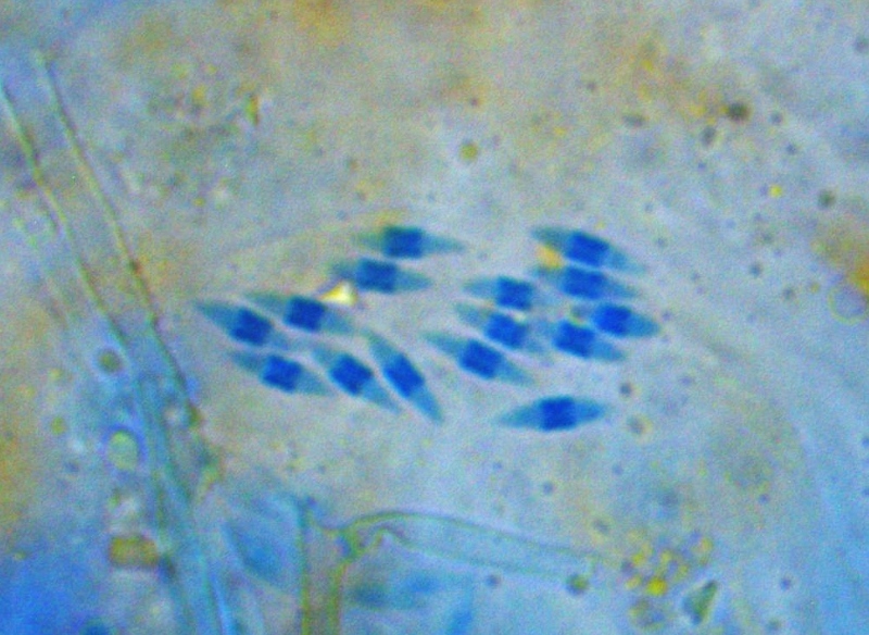 Bryocentria-metzgeriae-Hypocreales-Nectria-Parasit-Radula-complanata-Kratz-Lebermoos-Sporen-spindelfoermig-cyanophil-Wandverdickung-Mikroskopierkurs-Pilzseminar-Baden-Wuerttemberg 800x584