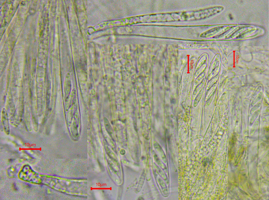 Bryoglossum gracile 3 Asci 8 sporig Schlaeuche Haken inoperculat Becherling Helotiales Krieglsteiner Kalkalpen Baral ascofrance Pilzschule Schwaebischer Wald Feldmykologe Pilzexpertin