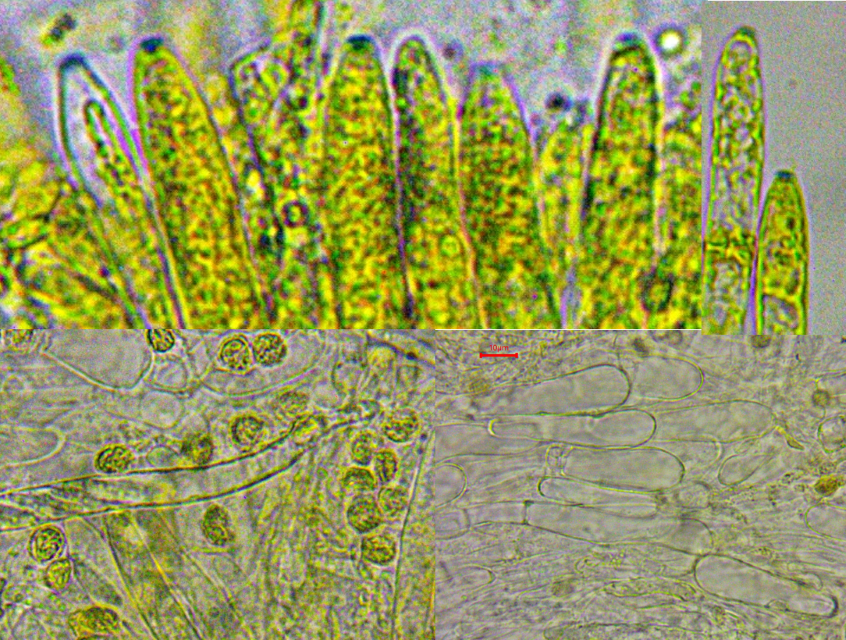 Bryoglossum gracile 6 Asci euamyloid Baralsche Lugol Loesung Jod Vitaltaxonomie Krieglsteiner Mikroskopierkurs Pilzschule Niedermoor basenreich sauer arktisch alpin Verbreitung Lebermoos