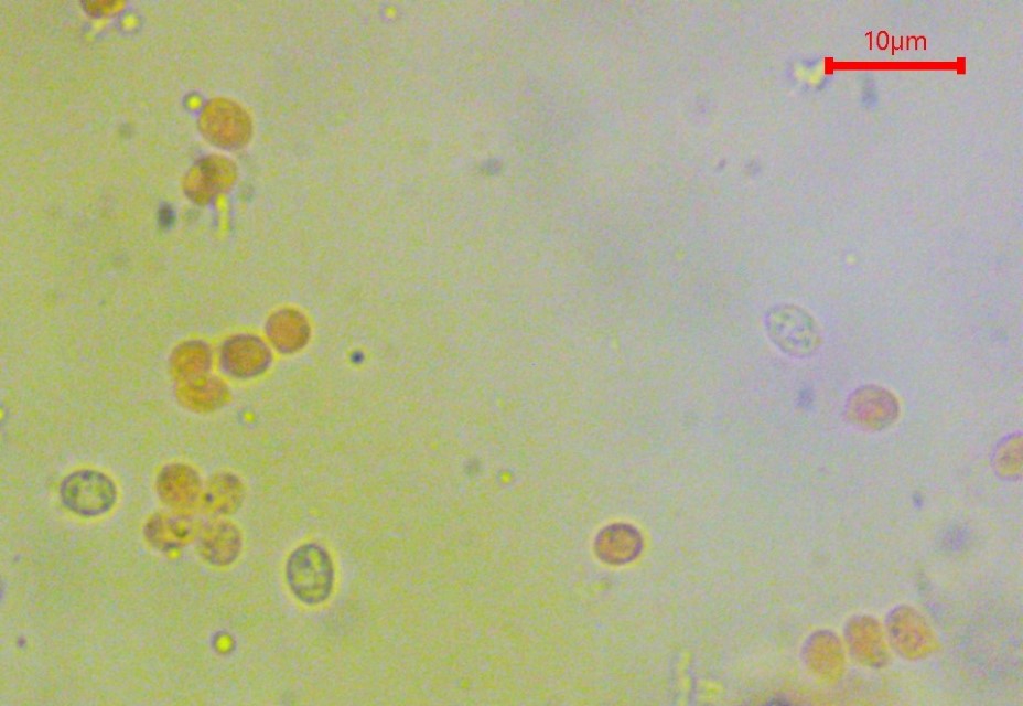 Clitocybe americana 10 Sporen Tetrade Basidie viersporig Kongorot Mikroskopie diatreta subbulbipes Pruina Reif Rhizoiden Malm Kalk Krieglsteiner Specht