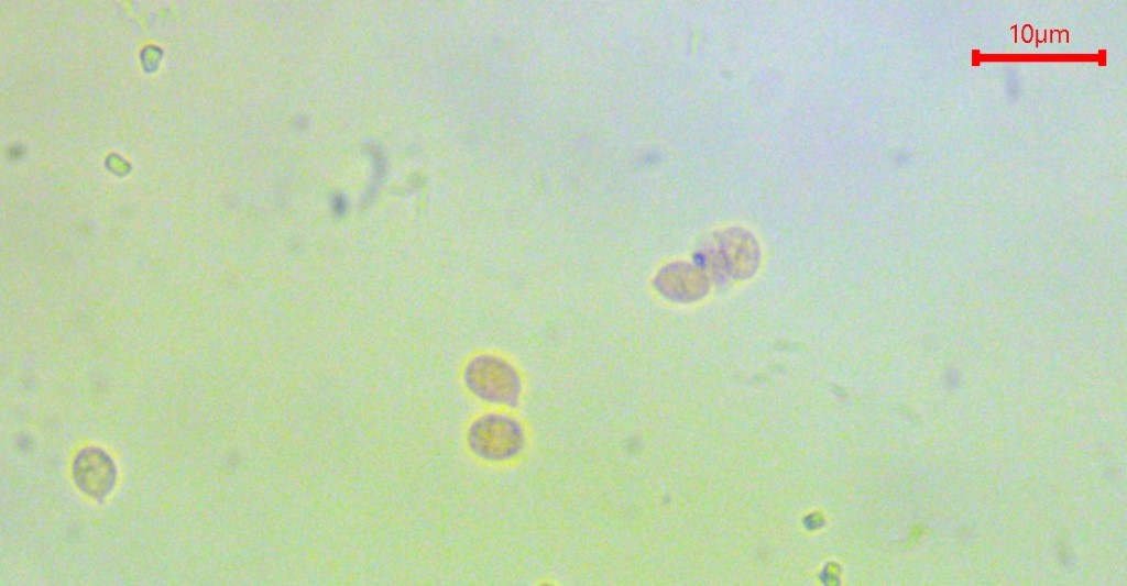 Clitocybe americana 13 subbulbipes Trichterling Holz diatreta giftig Muscarin Syndrom PSV Krieglsteiner Pilzschule Schwaebischer Wald