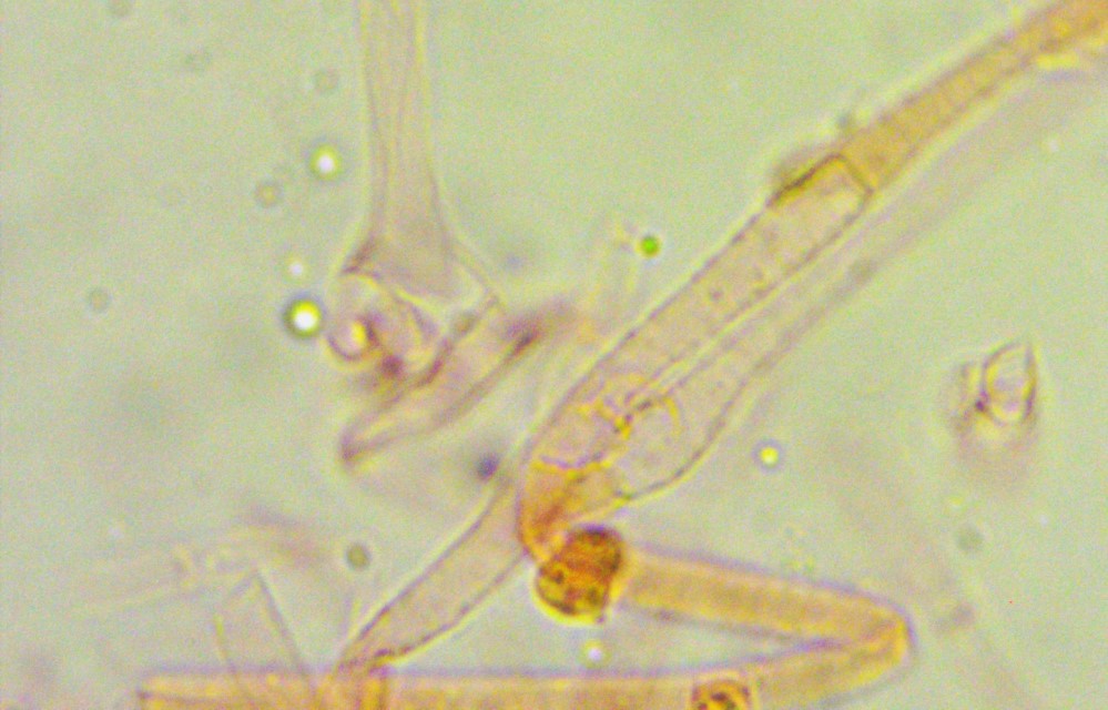 Clitocybe americana 8 Huthaut Hyphe inkrustierendes Pigment Kongorot subbulbipes Mikroskopie Feldmykologe Erstnachweis Oekologie diatreta DNA Tintling