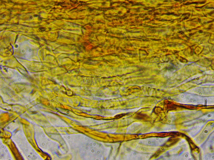 Cortinarius rufoallutus 8 Huthaut Schnitt Pigment zebra artig inkrustierend spiralig intrazellulaer Cutis Schnallen Mikroskopie Krieglsteiner Thaxterogaster