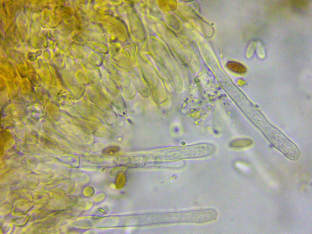 Crustoderma dryinum Mikroskopie Zystiden Staender Basidien Sporen Meruliaceae Polyporales Rindenpilz Corticiaceae Pilzkurs Medium
