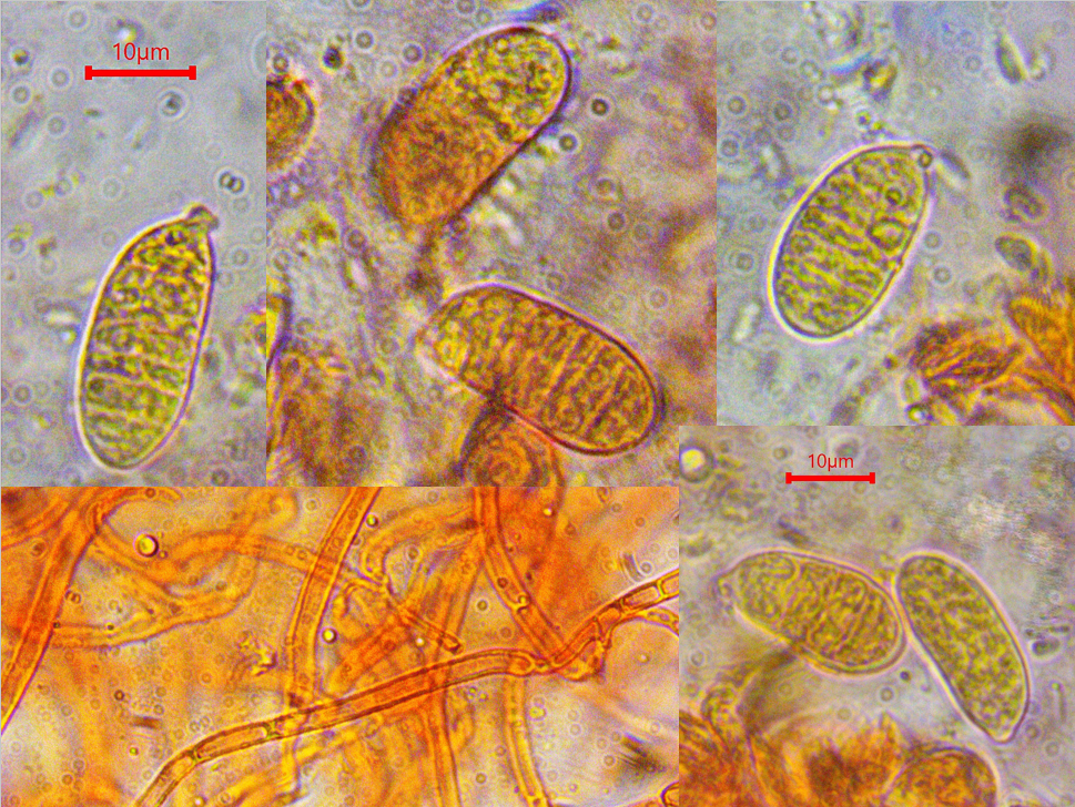 Dacrymyces estonicus 2 Sporen septiert breit Hyphen ohne Schnallen Heterobasidiomycet Stimmgabel Basidien Pilzschule Krieglsteiner Portugal Algarve Neufund iberische