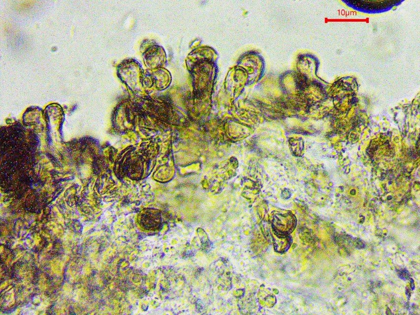 Echinoderma hystrix 6 Cheilozystiden schwarz pigmentiert keulig Lamellenschneide Baden Wuerttemberg Schwaebisch Hall Gaildorf Osterbachtal Feldmykologe Pilzkunde