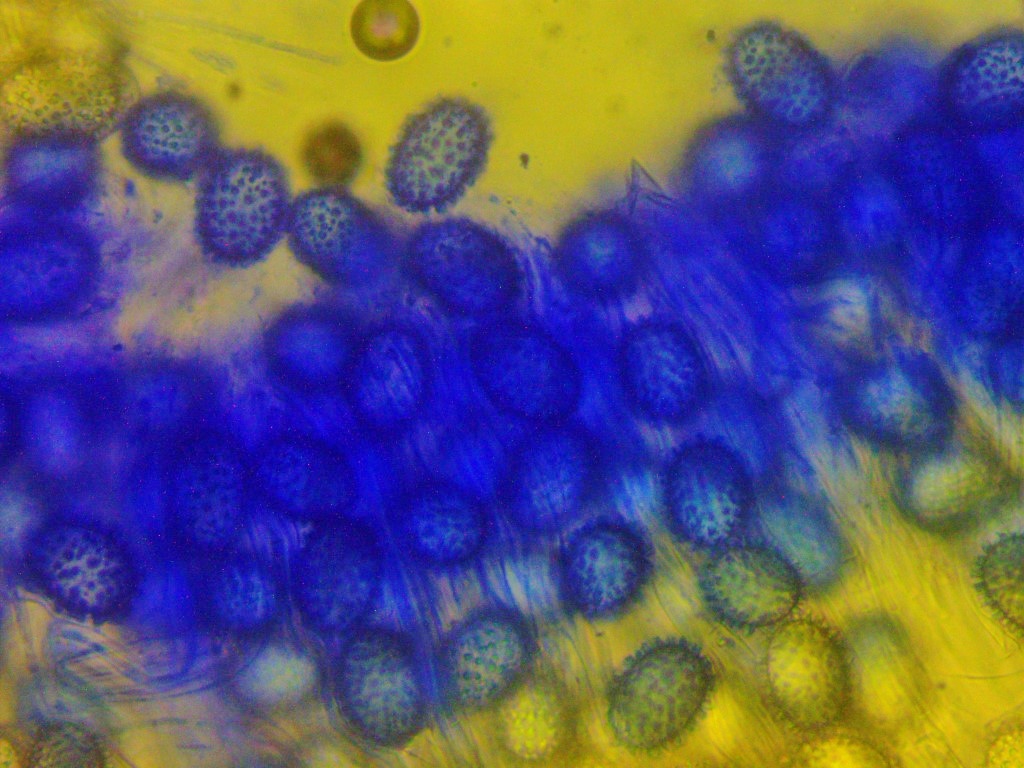 Genea hispidula Sporen Ornament Baumwollblau Vergroesserung 40 Nationalpark Eifel Nordhein Westfalen Trueffelkurs