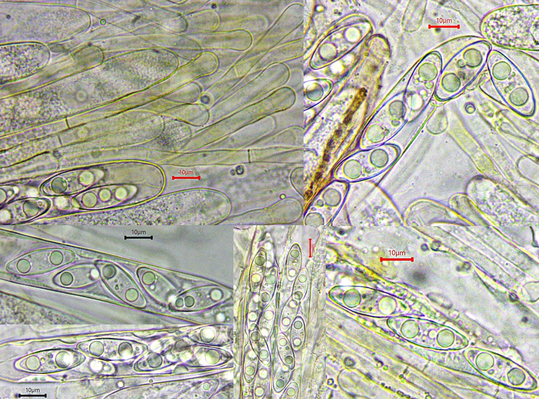 Gyromitra ambigua 2 Violettstielige Bischofsmutze Asci Sporen Paraphysen guttulat fusiform spindelig Paraphysen angeschwollen Mikroskopierkurs Krieglsteiner Pilzschule Schwaebischer Wald Feldmykologe Schweden