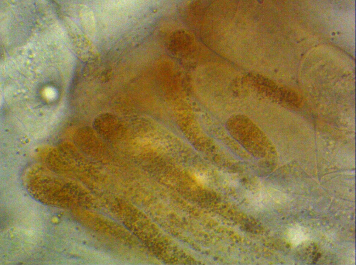 Gyromitra parma Mikroskopierkurs Paraphysen guttulat Pigment steril Fruchtschicht Morchel Lorchel Seminar Fuehrung Krieglsteiner Pilzschule