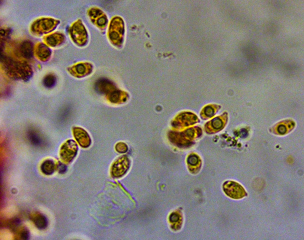 Hydropus pseudotenax 16 Sporen Kongorot Oeltropfen lebend Auerbachtal Kleinsporiger Wasserfuss Mykologie Krieglsteiner