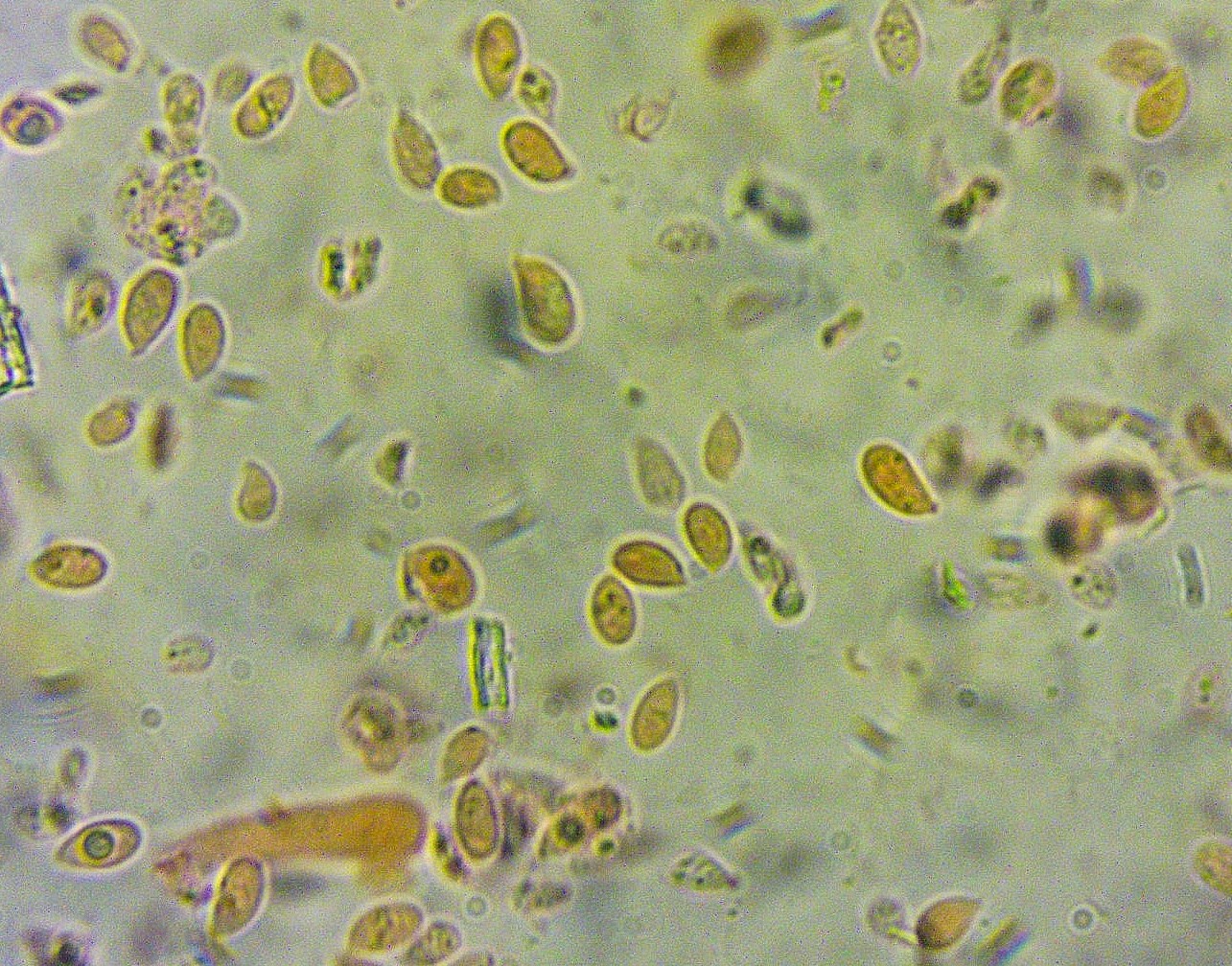 Hydropus pseudotenax 17 Sporen Kongo NH3 Ammoniak tot Apikulus Mycena Wasserfuss PSV DGfM Feldmykologe