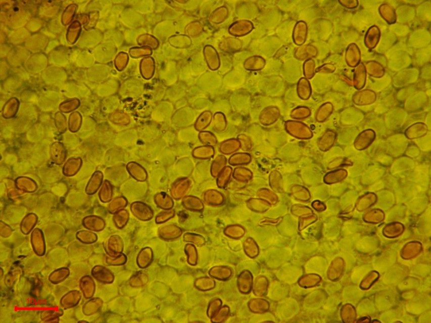 Hygrophoropsis fuscosquamula 7 Feinschuppiger Sumpf Afterleistling Sporen dextrinoid PIlzschule Schwaebischer Wald Mikroskopierkurs Feldmykologe