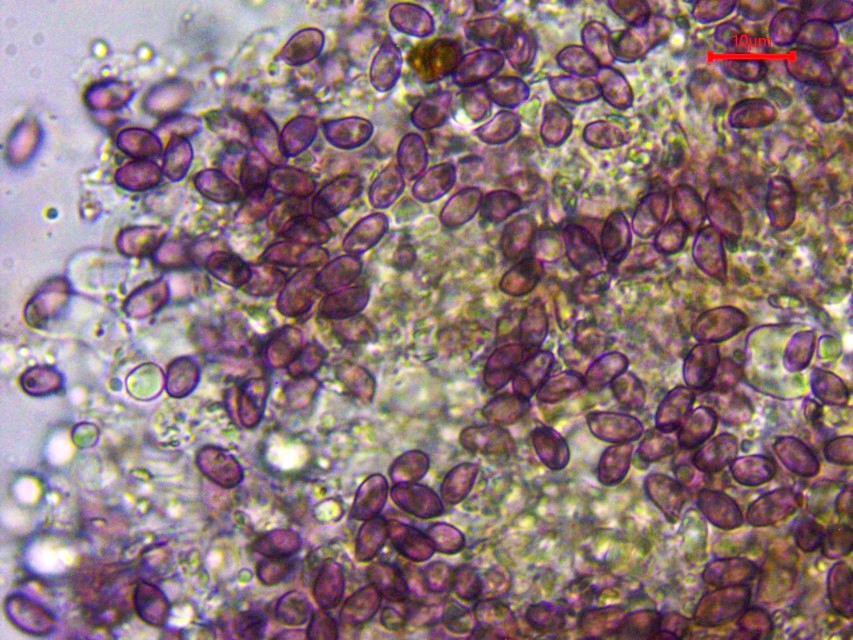 Hypochnella violacea 4 Sporen violett massenhaft reichlich Anamorphe Teleomorphe Stnder Basidie ohne Schnallen Mikroskopierkurs Krieglsteiner