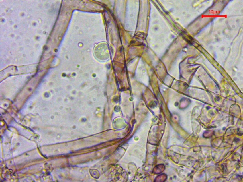 Hypochnella violacea 6 Mikroskopierkurs Algarve Portugal Barrocal Loule Tor Hyphen ohne Schnallen Sporen violett amyloid PSV DGfM Feldmykologe Krieglsteiner