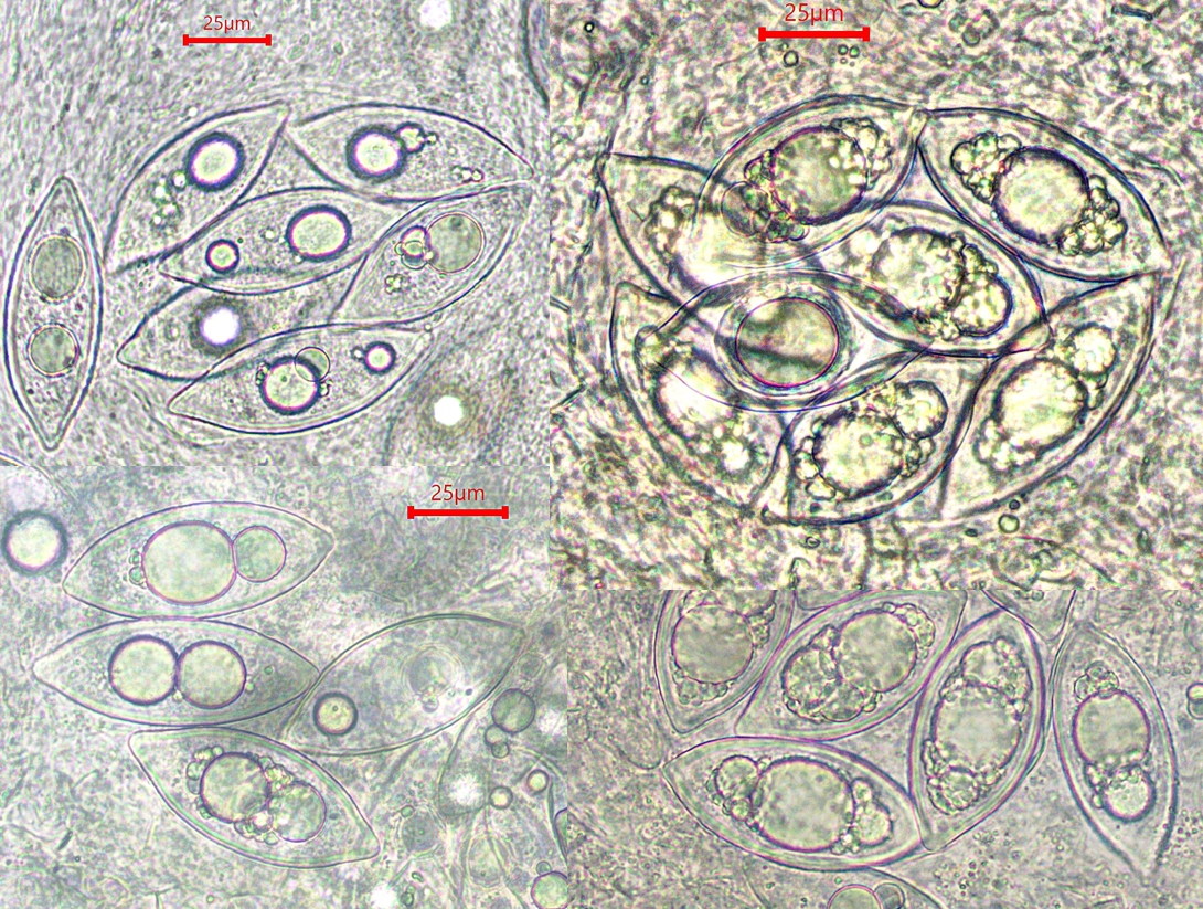 Leucangium carthusianum 2 Sporen unreif zugespitzt zitronfoermig oelreich Tropfen Guttulen Pilzschule Schwaebischer Wald Krieglsteiner Schnecklingskurs Pilzexperte Pilzexpertin Fichte