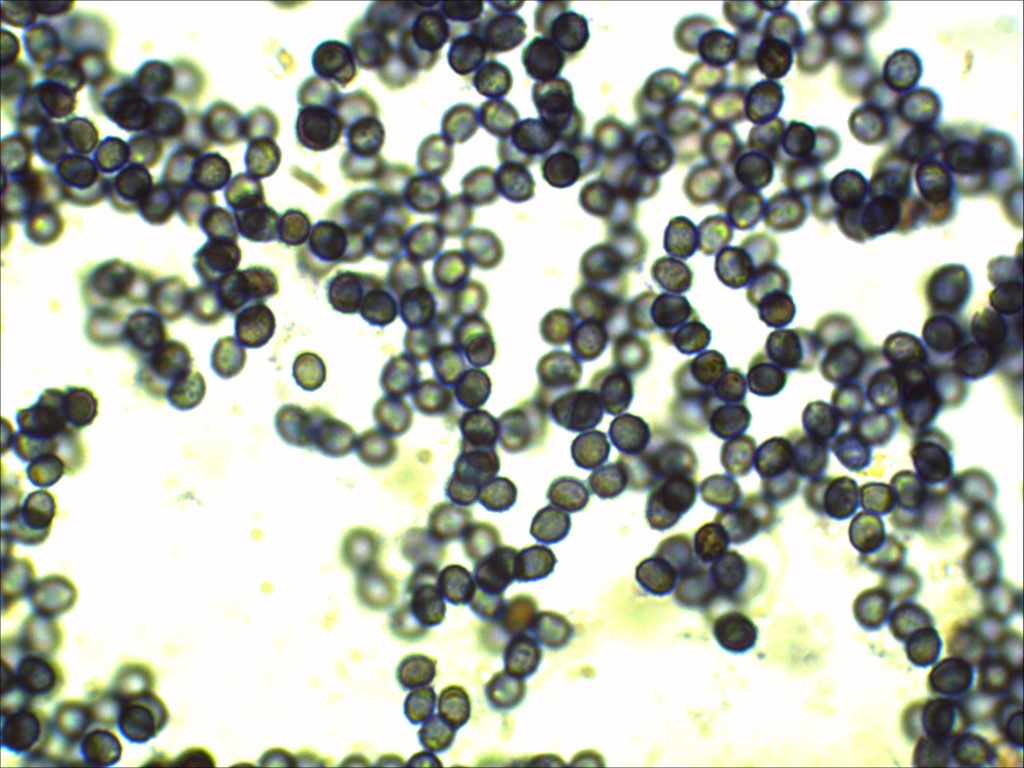 Leucopaxillus gentianeus Sporen stark amyloid ornamentiert warzig Lugol Melzers Reagens Staerke blau schwarz