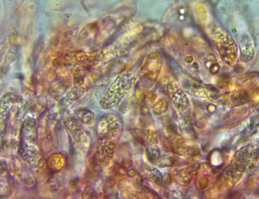 Lyophyllum brunneo ochrascens 15 Basidien viele kleine Tropfen siderophile Granulation Mikroskopie Krieglsteiner Pilzkurse Pilzschule Schwaebischer
