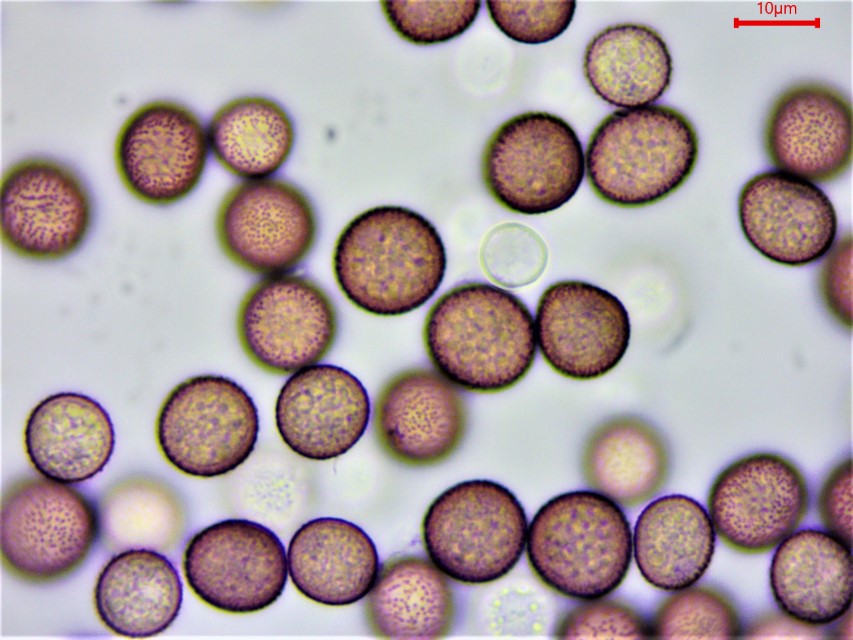 Microbotryum pustulatum 5 Sporen Ustilago Pucciniomycota Microbotryales Mikroskopierkurs Schlangenknoeterich Krieglsteiner Feldmykologe PilzCoach pilzexpertin