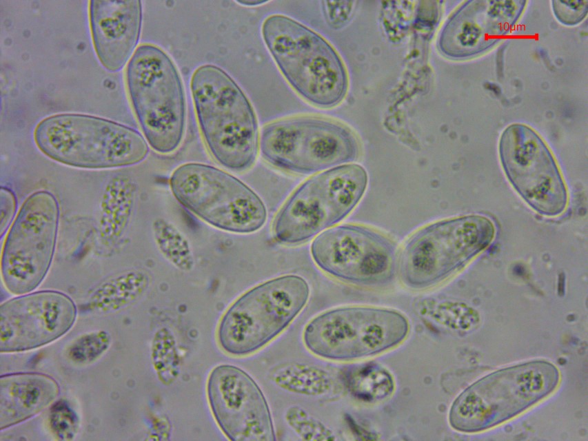 Monilinia baccarum 21 Sporen grosse kleine Mykologe Wasser Praeparat Praparat Immersion Mikroskopie Pilze Ascomyceten Schlauchpilze Becherlinge inoperculate Fruchte Custom