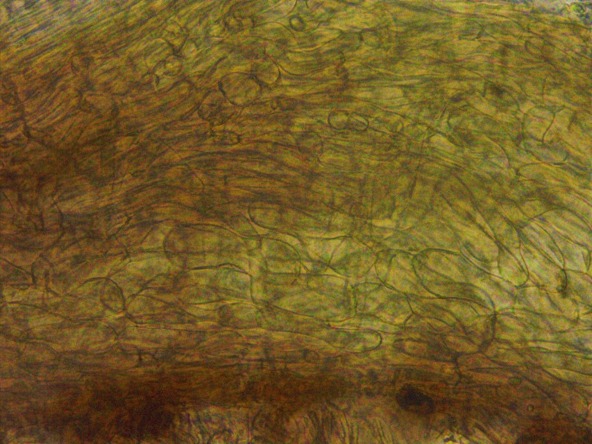 Monilinia baccarum 29 Excipulum Exzipulum Gehaeuse Zellen braunes Pigment pigmentiert Anatomie Becherlinge Mikroskopie Schnitt Pilzkenntnis Artenkenntnis biodivers Custom