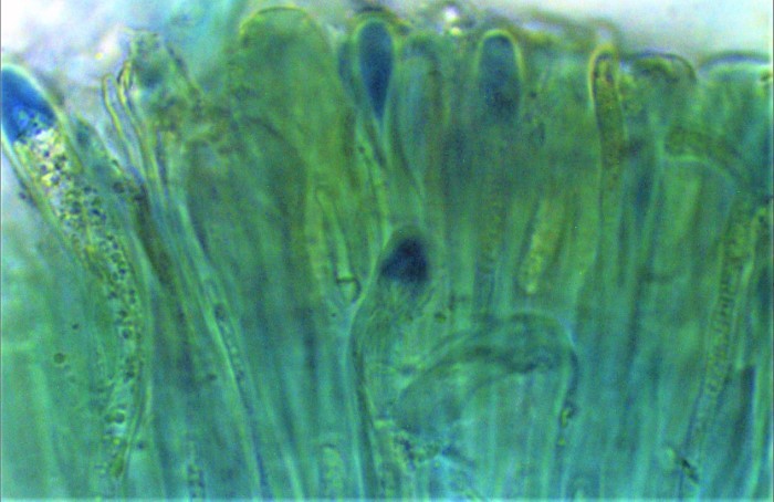 Mycobilimbia sphaeroides z Fruchtschicht unreife Asci Jod Baralsche Loesung blau Mikroskopierkurs Flechtenkurs Krieglsteiner Pilzschule Schwaebischer Wald