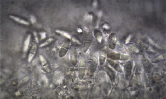 Mycobilimbia sphaeroides z Sporen Fruchtschicht zweizellig KOH Mikroskopierkurs Krieglsteiner Pilzschule Schwaebischer Wald Genozid Esche Kollateralschaden