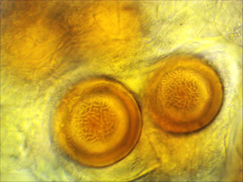 Physoderma potteri 11 Dauersporen Ornament Linien Galle Hornklee Lotus uliginosus Feuchtbiotop Feuchtgruenland Krieglsteiner Eifel