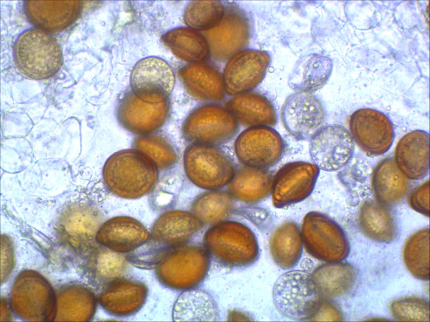 Physoderma potteri 5 Dauersporen Sporangien Mikroskopierkurs parasitische Pilze Pflanzengallen Pilzschule Schwaebischer Wald Eifel