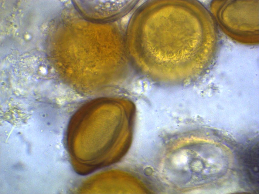 Physoderma potteri 7 Urophlyctis Lotus uliginosus Fabaceae abgeflacht Muster Rillen Dauersporen Chytridiomycota parasitische Pilze
