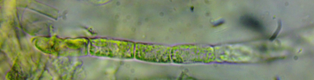 Russula adulterina 9e Scharfer Brauntaeubling Zystide septiert mehrfach Russulales Gloiodon strigosus Artomyces pyxidatus Hericium coralloides erinaceus alpestre