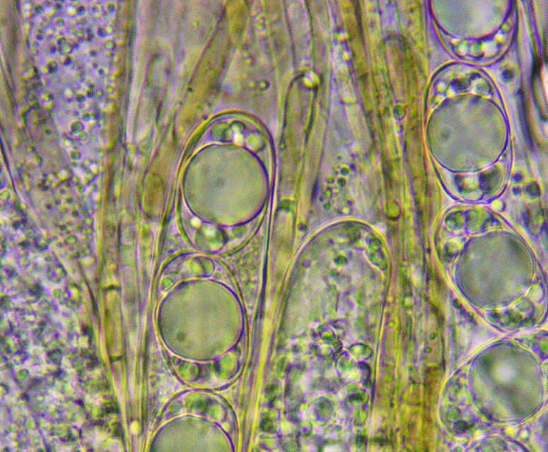 Wynnella silvicola 8 atrofusca Otidea auricula Asci Sporen Paraphysen Pigment Mikroskopie molekular Lorchel Oehrling Mykorrhiza Lederiger Gebirgsklima subalpin