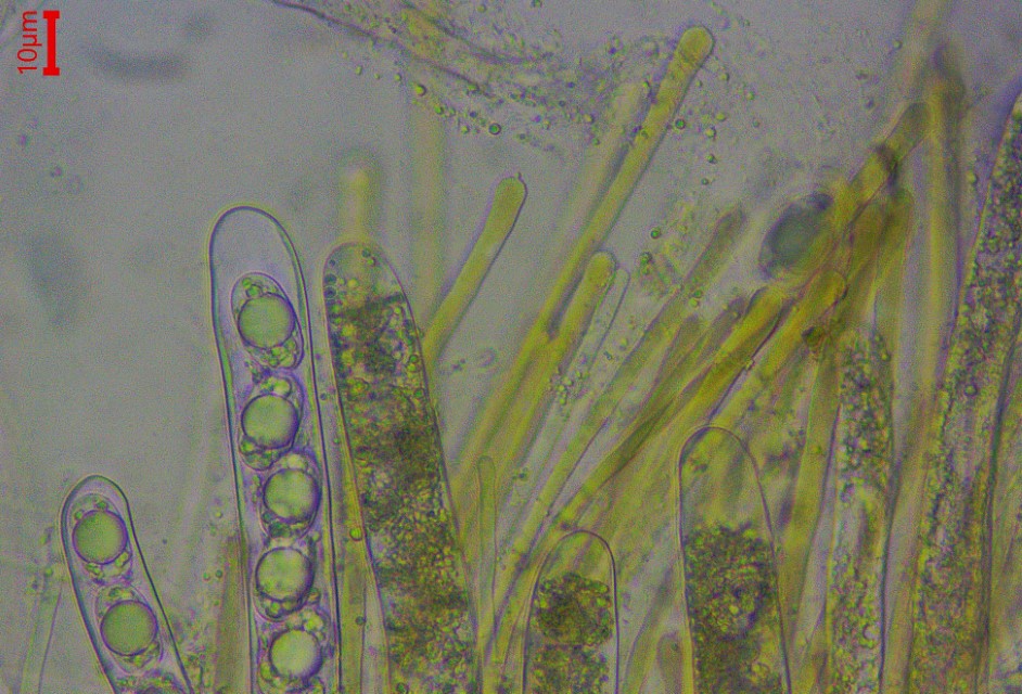 Wynnella silvicola 9 Asci Paraphysen braun pigmentiert Hymenium Fruchtschicht Krieglsteiner Mikroskopie Lorchel Helvella Sporen eifoermig Feldmykologe PSV Ausbildung